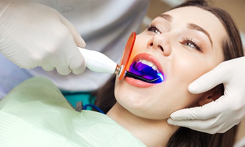 Woman receiving dental bonding treatment