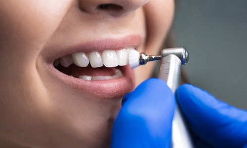 Closeup of Braintree dentist performing teeth cleaning