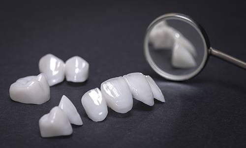 Dental restorations prior to placement