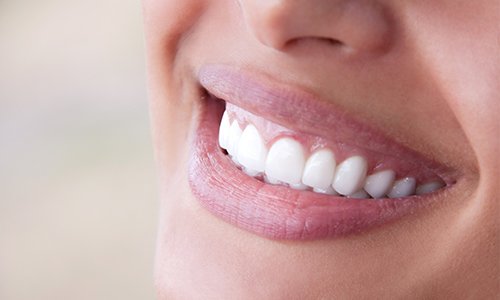 Closeup of bright white smile