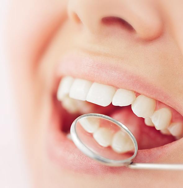 Braintree dentist inspecting tooth-colored filling