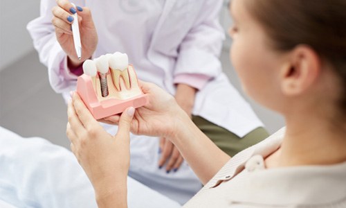 closeup of dental implants in a dentist’s hands