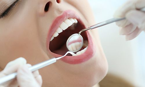 Closeup of patient during dental treatment