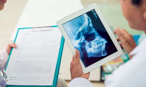 Jaw and skull x-rays